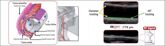 Dr Membrino esaote RF-QIMT