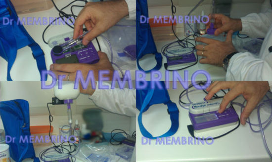 Dr Membrino NEC preparazione nutripompa NUTRICIA flocare infinity