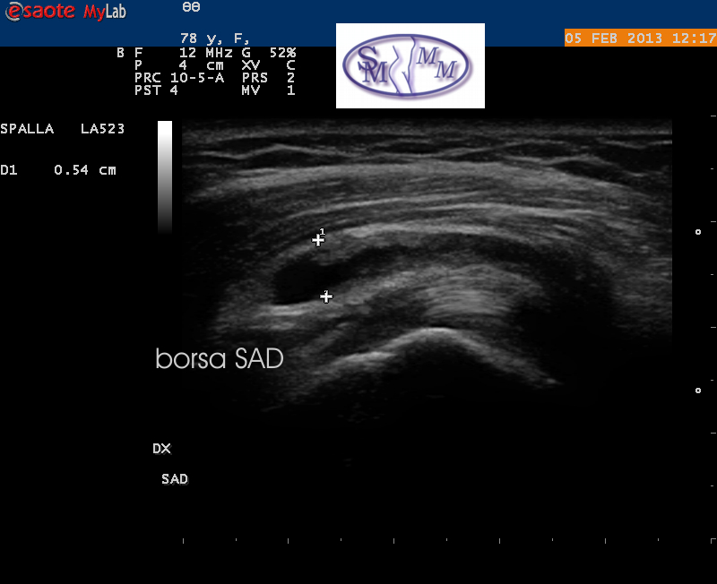 Dr Membrino borsa sad